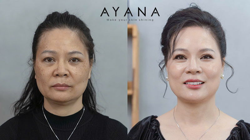 review-ayana