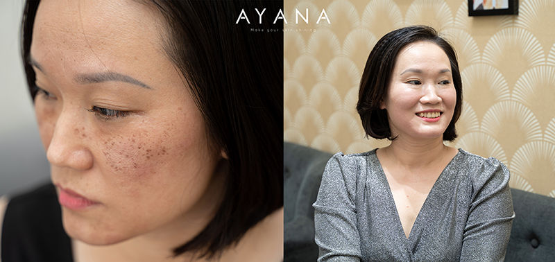 review-ayana