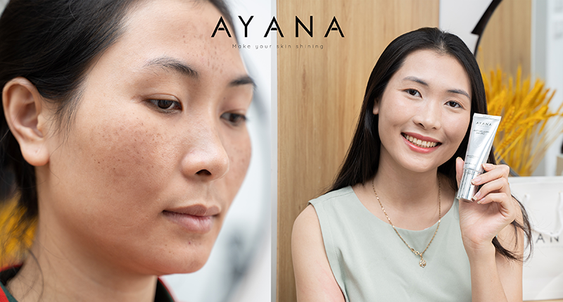 review-ayana
