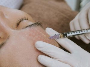 cham-soc-da-sau-tiem-meso