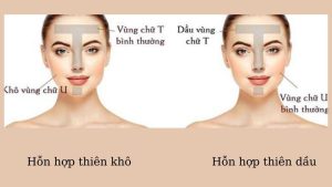 cham-soc-da-hon-hop-thien-kho