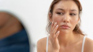 cham-soc-da-o-tuoi-day-thi