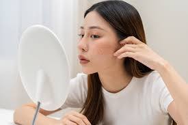 phu-nu-sau-40-tuoi-tri-nam-can-luu-y-nhung-gi