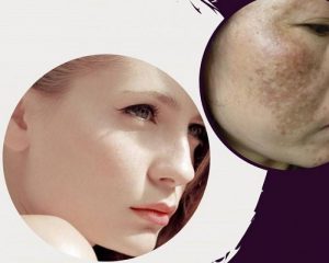 vi-sao-tri-nam-lau-nam-rat-de-tai-phat