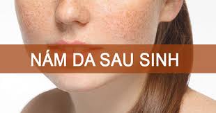 nam-sau-sinh-bao-lau-thi-cai-thien
