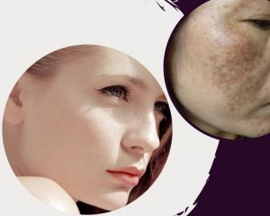 Da Nám Nên Dùng Serum Gì