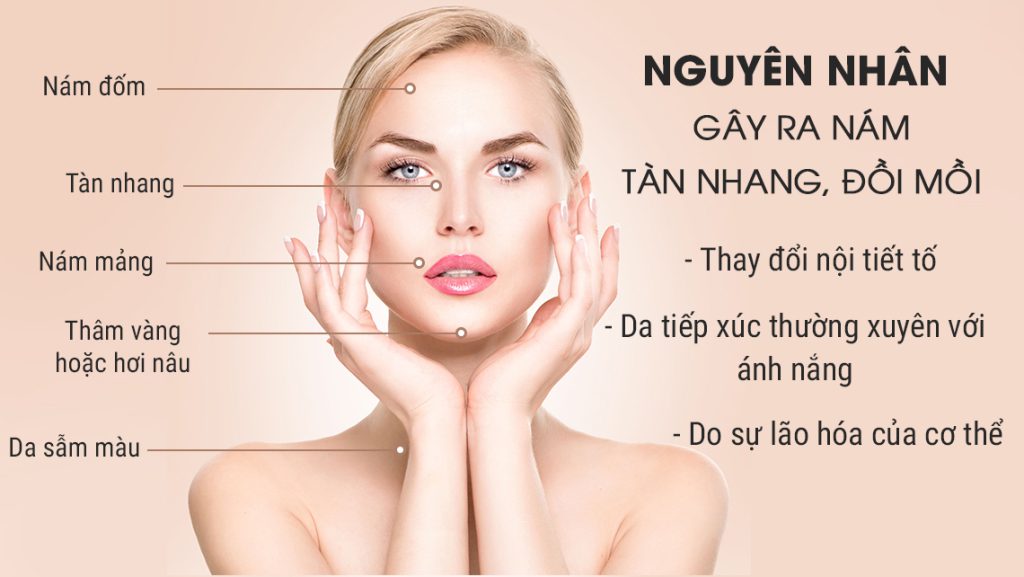 Nguyên Nhân Gây Nám Da Ở Phụ Nữ Sau Tuổi 30