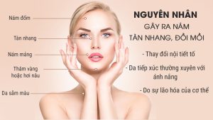 Nguyên Nhân Gây Nám Da Ở Phụ Nữ Sau Tuổi 30