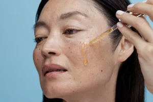 Da Nám Có Nên Dùng Niacinamide Không