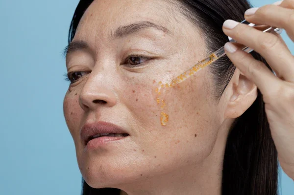 Da Nám Có Nên Dùng Niacinamide Không