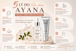 5-ly-do-chon-ayana