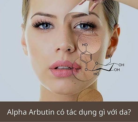 Da Nám Có Nên Dùng Alpha Arbutin Không