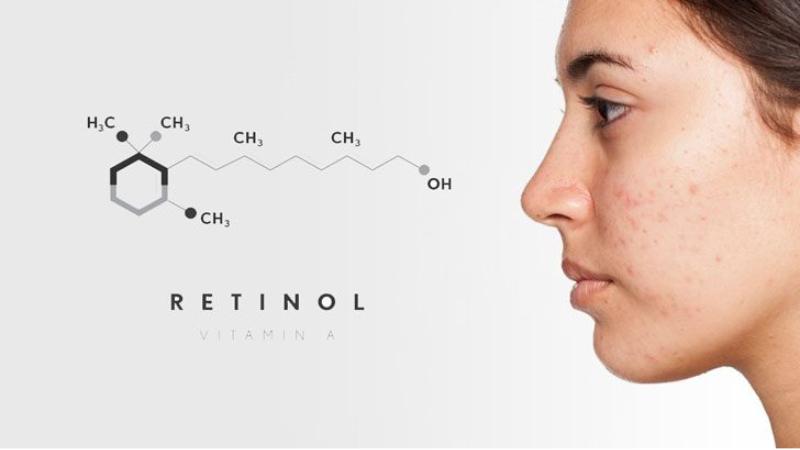 Da Nám Có Nên Dùng Retinol Không